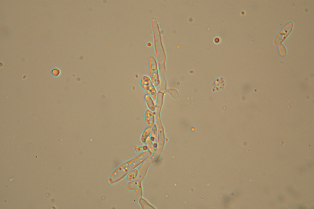 Postia caesia parassitizzata o con forma imperfetta?